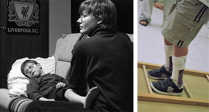 Left: My mom is stretching my muscles which are tight due to cerebral palsy. This has been part of my routine since I was two.
Right: I'm stepping between the rungs of a ladder at the Movement Centre of Manitoba.