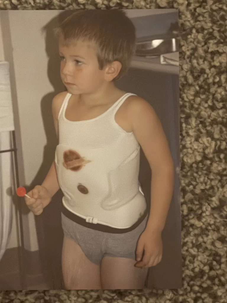 Three year old Spencer standing with his brace on.